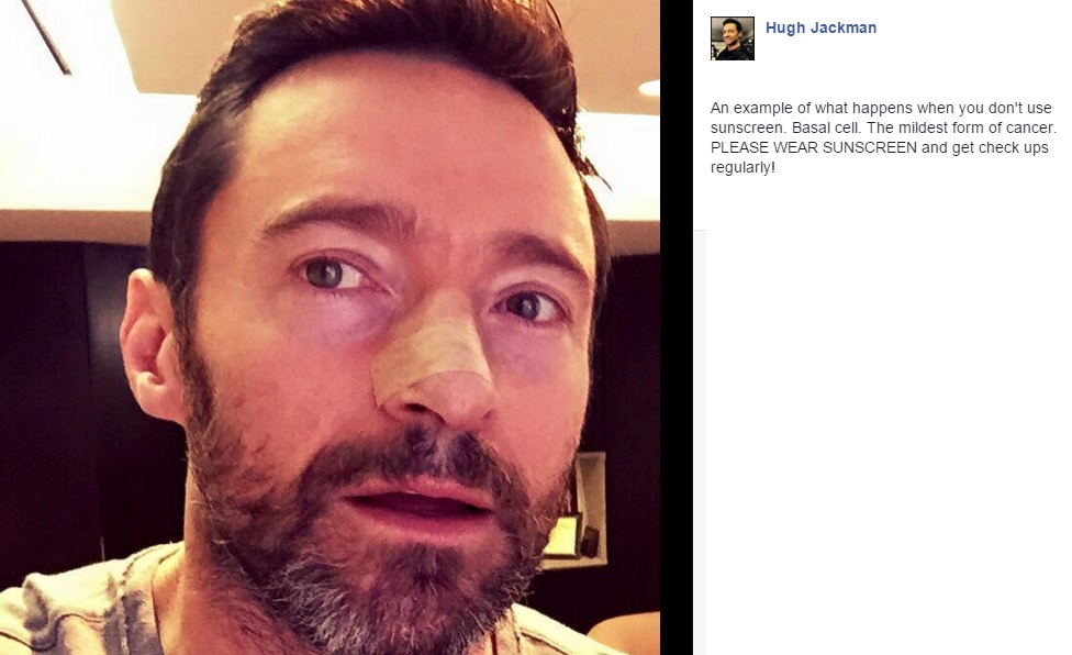 hugh-jackman