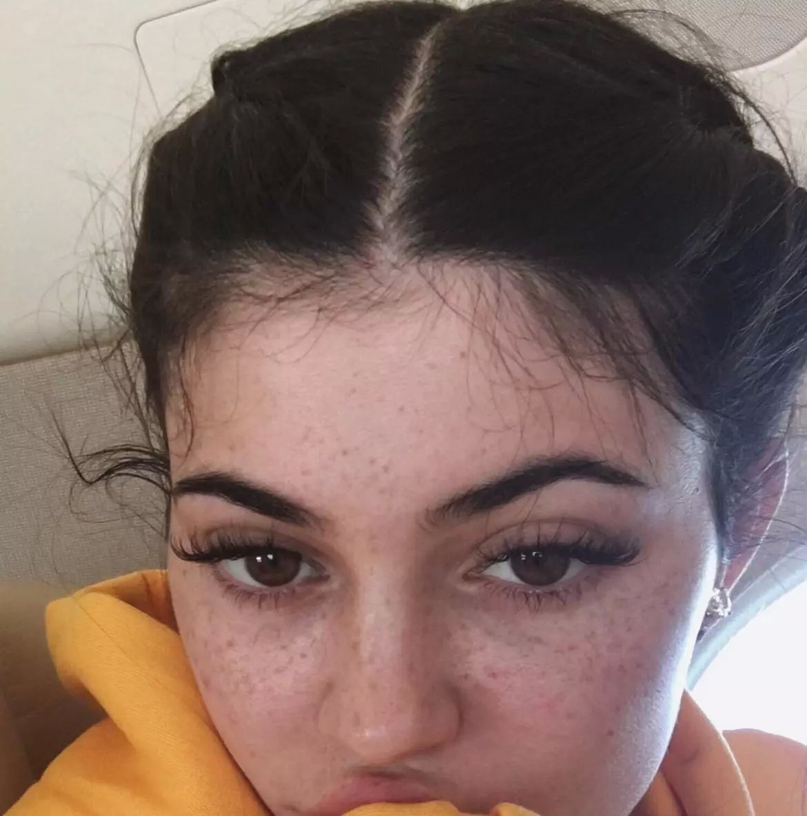 kylie-jenner-freckles (1)