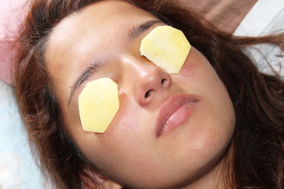 potato-slices-on-eyes